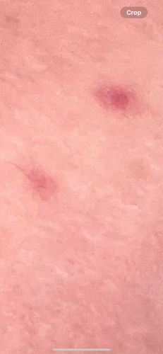 There is no identifiable bug or insect in the provided image.