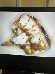 Unidentifiable Debris