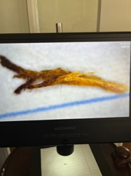 Unidentified Organic Matter (likely plant fiber)