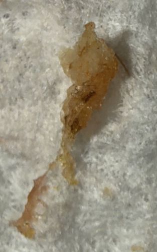 Not an Insect (Likely Earwax or Dried Bodily Secretion)