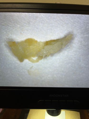 Unidentifiable organic material