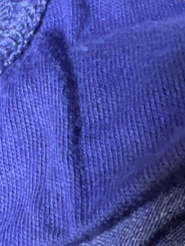 No insect or bug identified