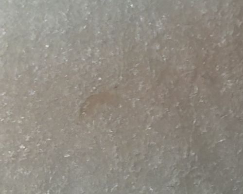 Body Louse (or Head Louse) - Nymph Stage