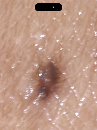 Lone Star Tick