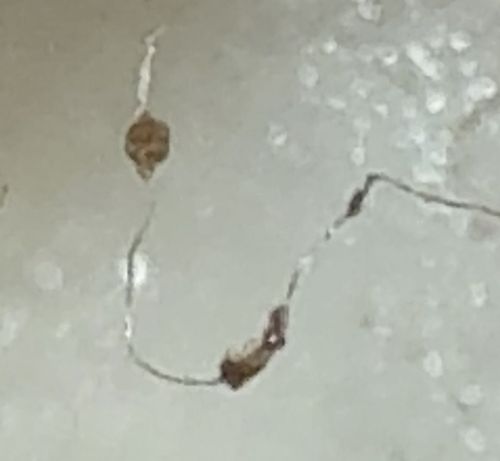 Review necessary - Image unclear but suggestive of a burrowing mite or thread