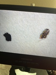 Carpet Beetle (likely Varied Carpet Beetle or Black Carpet Beetle larva)