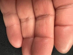 No insect or bug detected