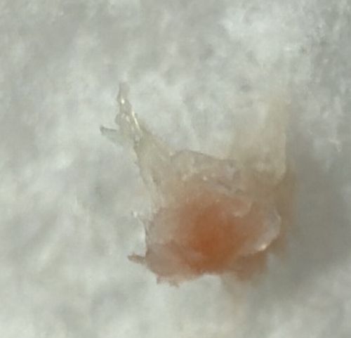 Non-Biological Material (Likely Dried Skin, Mucus, or Food Residue)