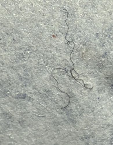 Lint / Thread / Human Hair (Not a living organism)
