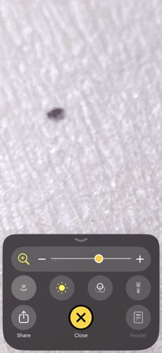 Pubic louse (or Crab louse)