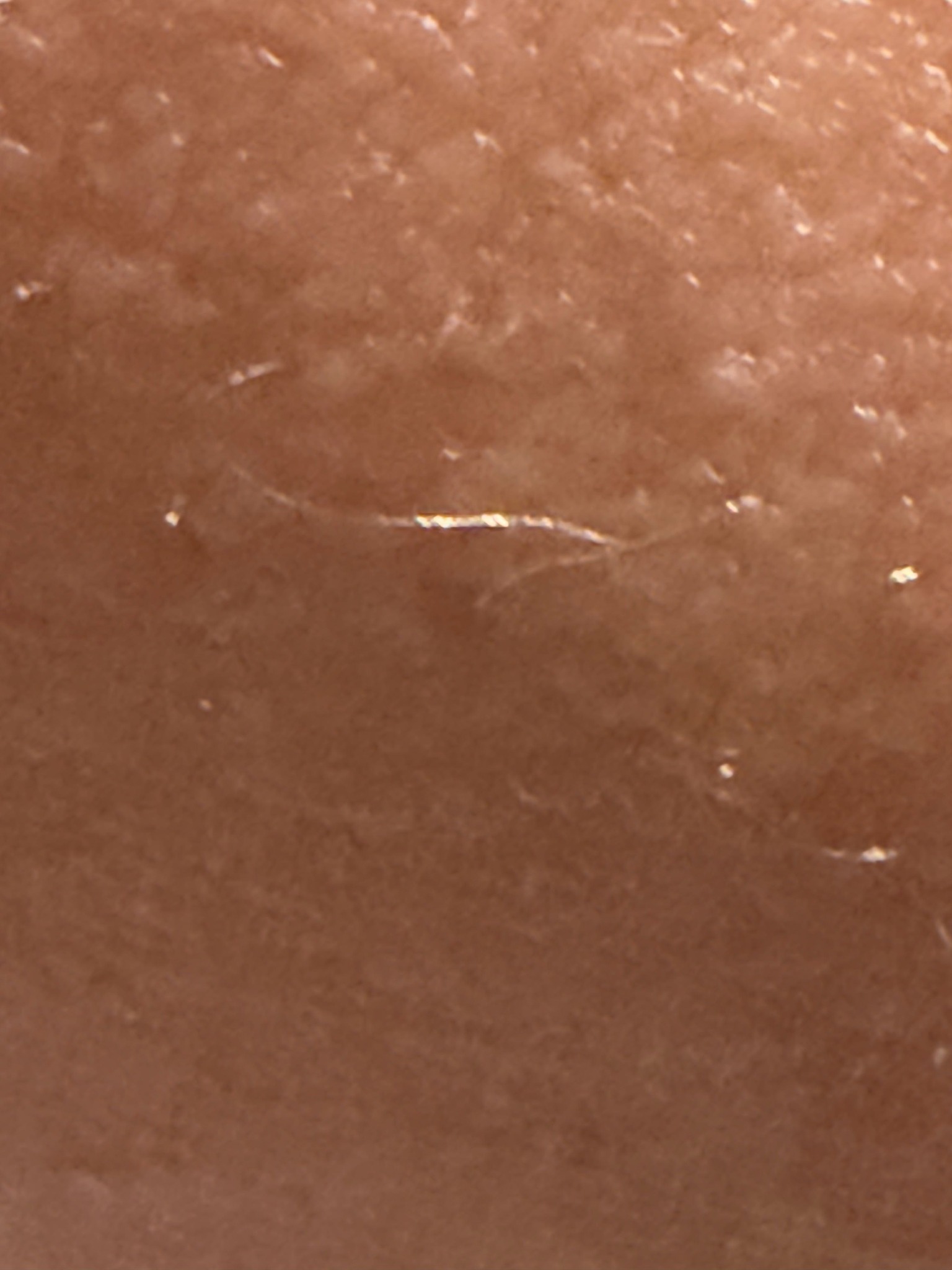Human Itch Mite