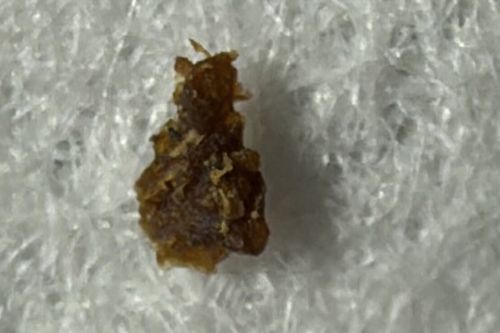 Bed Bug