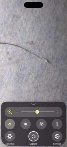 Head Louse (Nit)