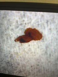 Insect Frass (Excrement)