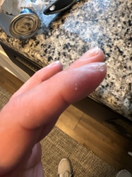 There is no identifiable bug or insect in the image.