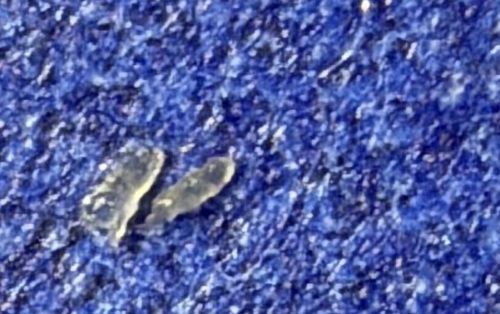 Skin Flake or Debris (Not an Insect)