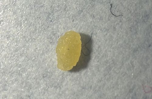 Tapeworm Segment (Proglottid)