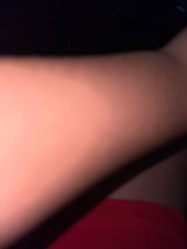 Unknown (Insufficient Visual Evidence)