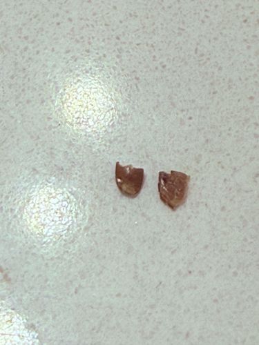Insect Exoskeleton Fragments (Likely Beetle or Cockroach)