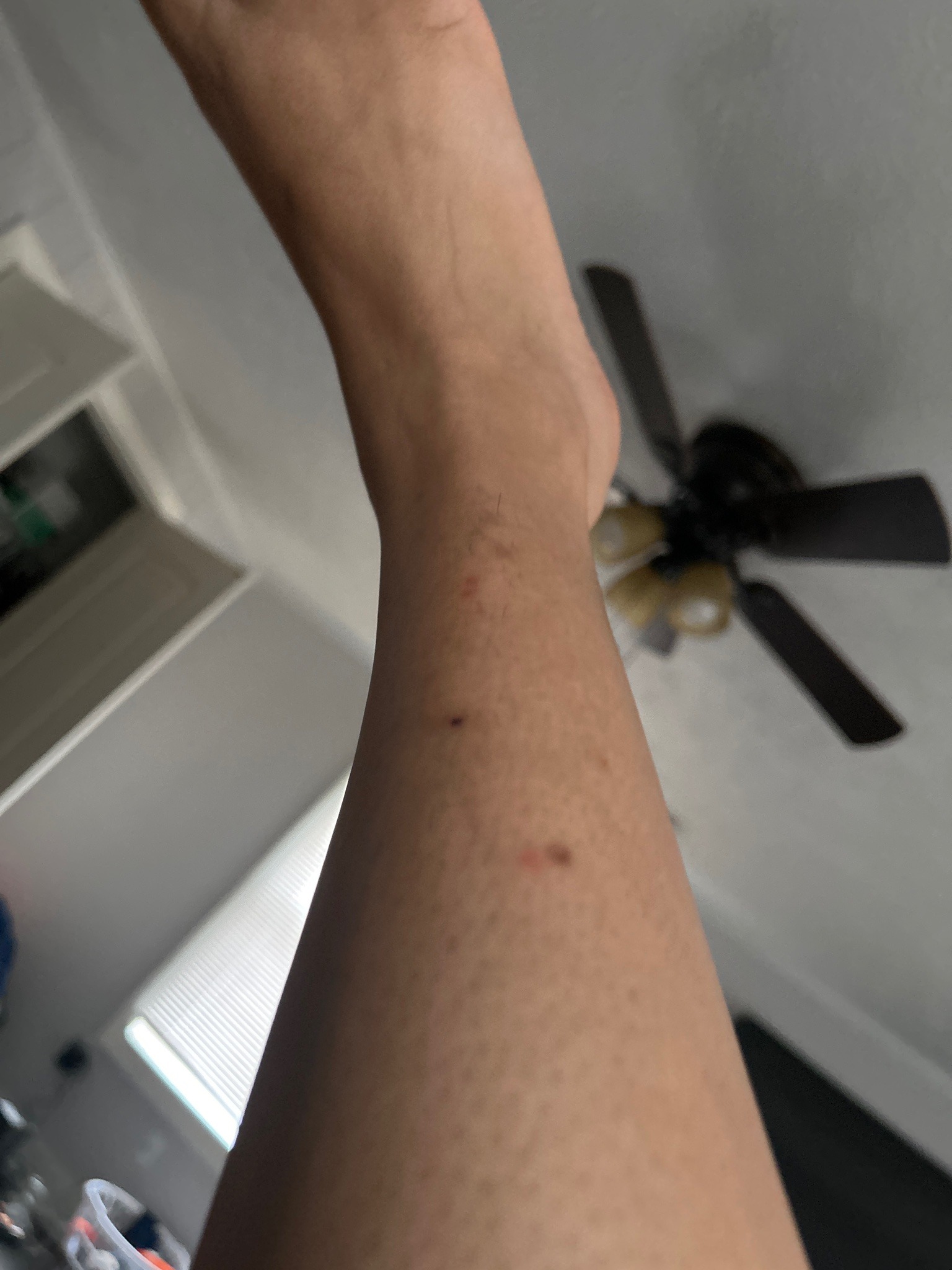 Bed Bug