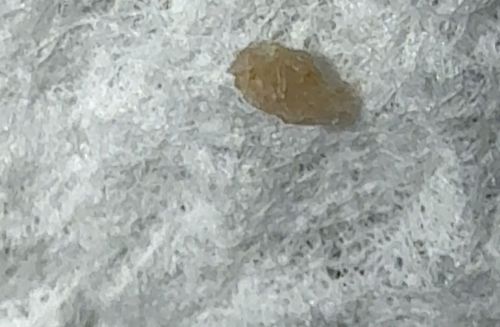 Tapeworm Segment (Proglottid)