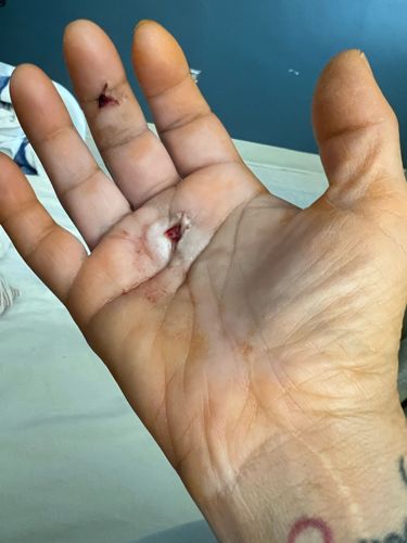 No insect or bug identifiable