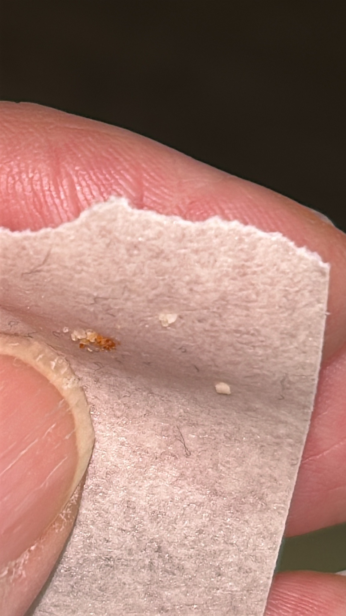 Bird mite