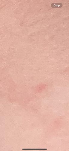 Not identifiable (No insect/bug visible)