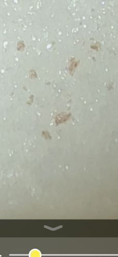 Grain Mite (Likely tentative identification due to image quality)