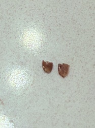 Insect Exoskeleton Fragments (Likely Beetle or Cockroach)