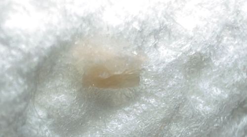 Not a Bug (Likely Skin Flake or Debris)