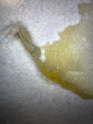 Unidentifiable insect fragment/debris