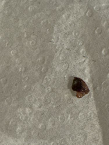 Unidentifiable Fragment