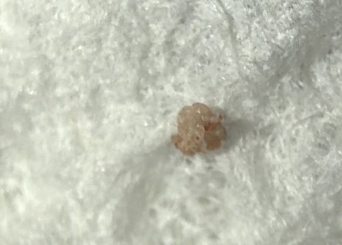 Carpet Beetle Larva (Early Instar) or Skin Flake/Debris (False Positive)