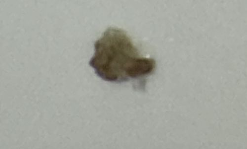 Junk bug (Green Lacewing Larva)