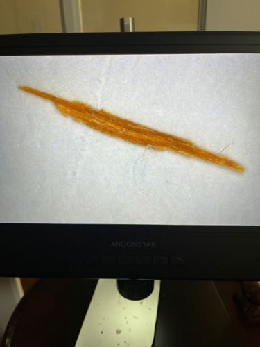 Not an insect/bug; likely a fiber or plant material