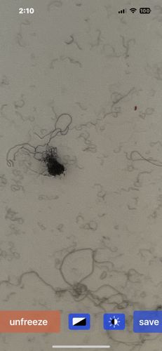 Nematode (Roundworm)