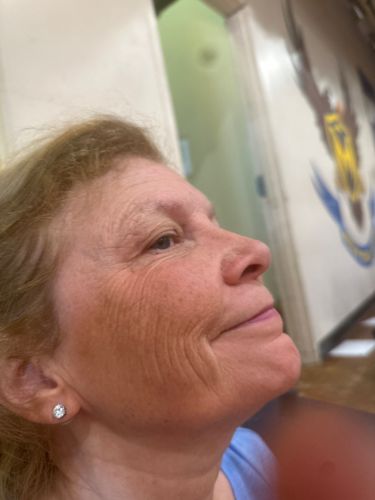 Not identifiable as an insect