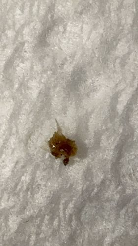 Inconclusive (Likely debris or non-insect material)
