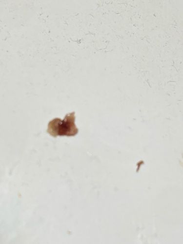 Inconclusive (Likely non-insect debris)
