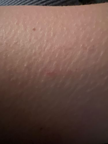 Inconclusive (Requires clearer image of actual insect)