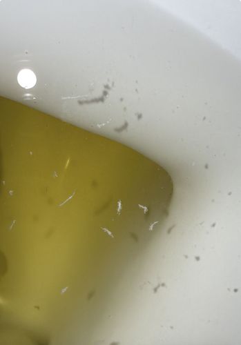 Drain Fly Larvae