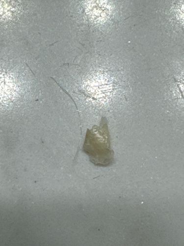 Unidentifiable insect remnant or debris