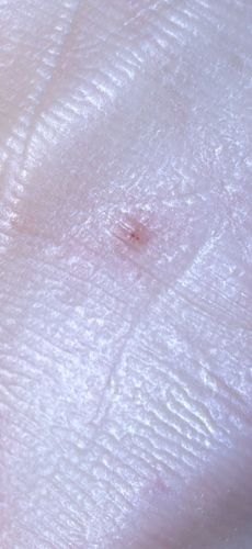 Bird Mite (or possibly Rodent Mite)