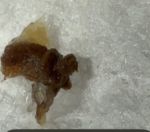Inconclusive (Non-biological material or specimen remains)