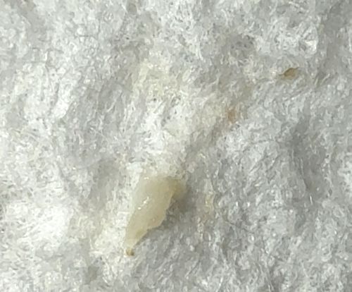 Sebaceous Filament / Skin Plug (Not an insect)