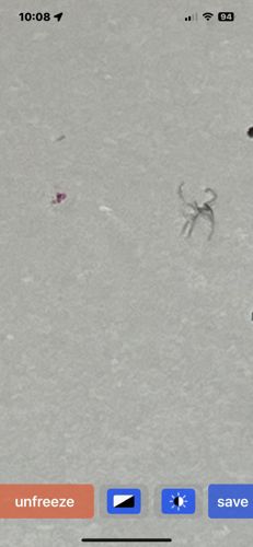 It is not possible to identify the organism from the provided image. The image is too blurry and the object is too small and indistinct to make a positive identification.