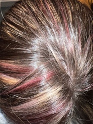 Human Head Louse (nit/egg stage)