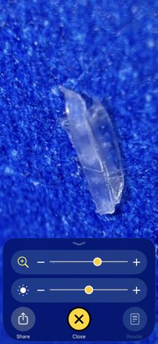 Inland Floater (Glochidium Larva stage)