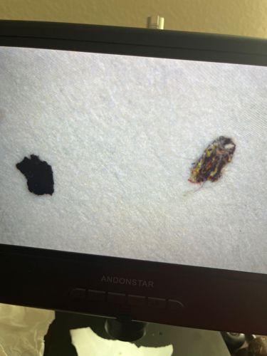 Carpet Beetle (likely Varied Carpet Beetle or Black Carpet Beetle larva)